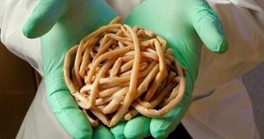 pasożyty ekstrahowane z organizmu człowieka