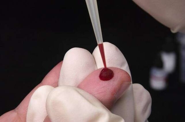 pobieranie krwi do analizy na obecność pasożytów
