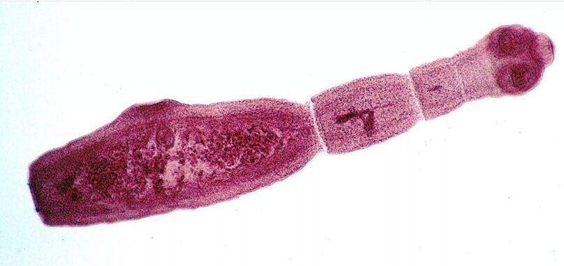 Echinococcus to jeden z najgroźniejszych pasożytów człowieka