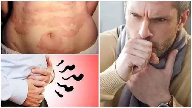 Alergie, kaszel i wzdęcia to oznaki uszkodzenia organizmu przez robaki